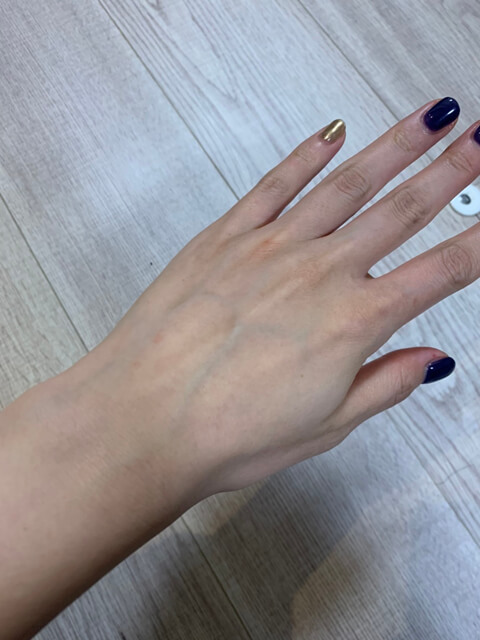 手