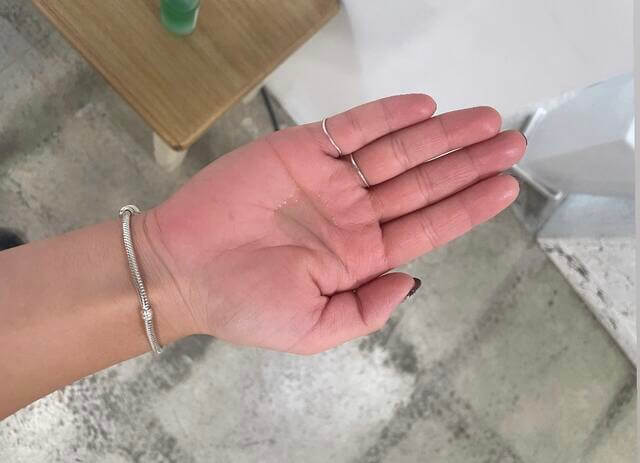 手